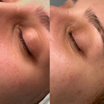 Ірина Акуленко, Киев Фото - 46