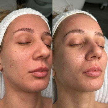 Ірина Акуленко, Киев Фото - 45