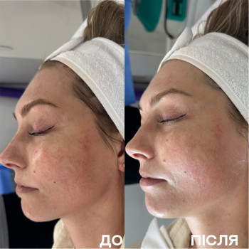 Ірина Акуленко, Киев Фото - 37