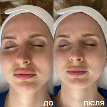 Ірина Акуленко, Киев Фото - 19