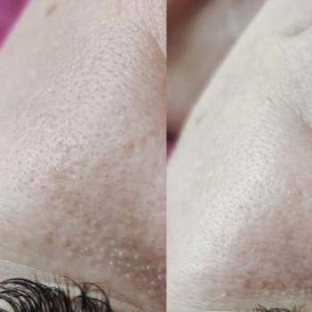 Фото из портфолио мастера Ирина Гарбуз (мастер депиляции, Киев)