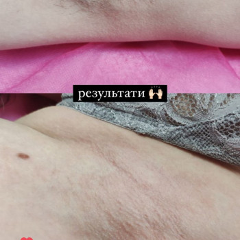 Фото из портфолио мастера Ирина Гарбуз (мастер депиляции, Киев)