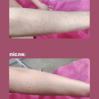Фото из портфолио мастера Ирина Гарбуз (мастер депиляции, Киев)