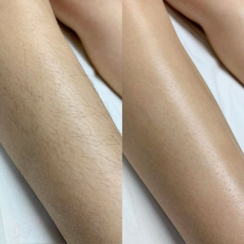 Фото из портфолио мастера Ирина Гарбуз (мастер депиляции, Киев)