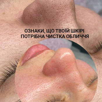 Фото из портфолио мастера Ирина Гарбуз (мастер депиляции, Киев)