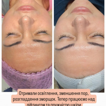 Фото из портфолио мастера Ирина Гарбуз (мастер депиляции, Киев)