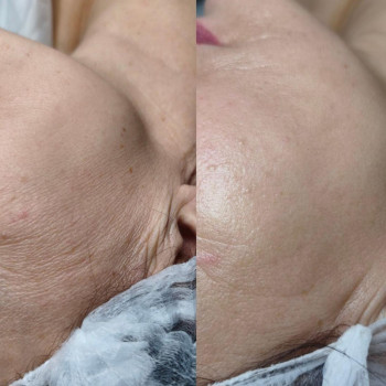 Фото из портфолио мастера Ирина Гарбуз (мастер депиляции, Киев)