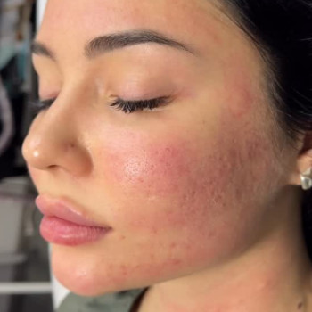 Диана Хусеинова, Киев Фото - 1