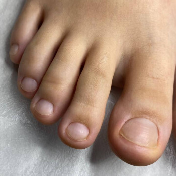 Гігієнічний педикюр пальчиків в комбінованій техніці