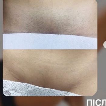 Lazer-KA, Киев Фото - 5