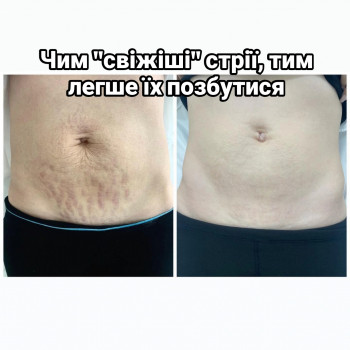 Олександр Шадських, Київ Фото - 2