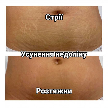 Олександр Шадських, Київ Фото - 3