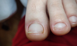 Гігієнічний апаратний педикюр - жіночий Ногтевая студия Beautiful nails Ивано-Франковск