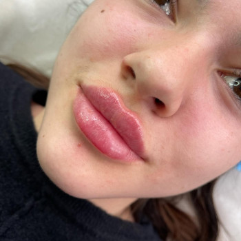 Не повірите, але в цих від природи шикарних губах - усього 0,3 мл.