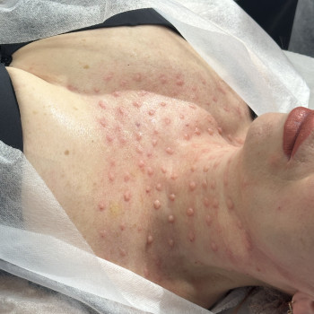 Ірина Акуленко, Киев Фото - 32