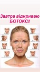 Ботокс три зони Лікар-косметолог Христина Тернопіль