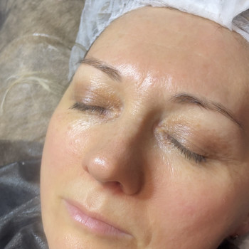 Abyss Glow Care | Карбоксітерапія
                    Косметолог-естетист Светлана Харків