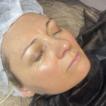 Abyss Glow Care | Карбоксітерапія
                    Косметолог-естетист Светлана Харків