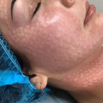 ✅БИОРЕВИТАЛИЗАЦИЯ

GANA BOOSTER – уникальный препарат, который способен обеспечить полноценную ревит...