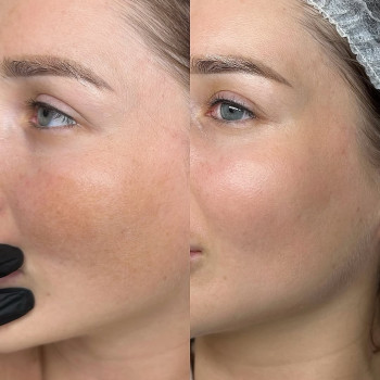 Вікторія Соболевська, Житомир Фото - 5