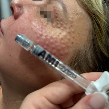 Анастасія Коваленко, Харків Фото - 12