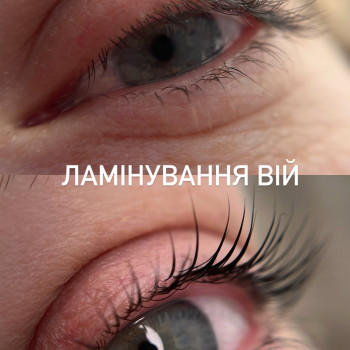 Лілія Смик, Біла Церква Фото - 26