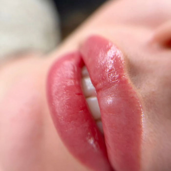 Лілія Смик, Біла Церква Фото - 20