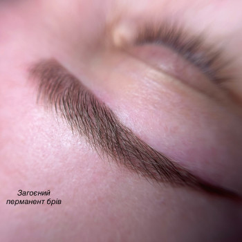 Лілія Смик, Біла Церква Фото - 5