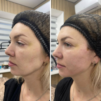 Ксения Дидур, Кропивницкий Фото - 22