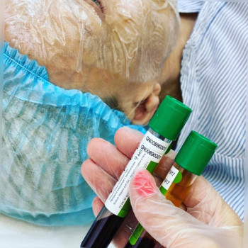 Плазмогель