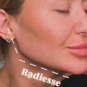 Ксения Дидур, Кропивницкий Фото - 31