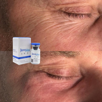 Juvelook полімочка