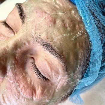 Ферментотерапія