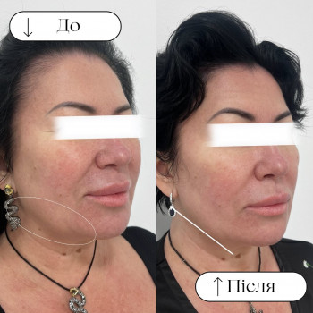 Trembachova, Киев Фото - 6