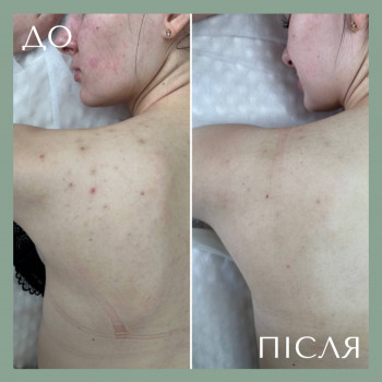 Фото из портфолио косметолога Эллина (Киев)