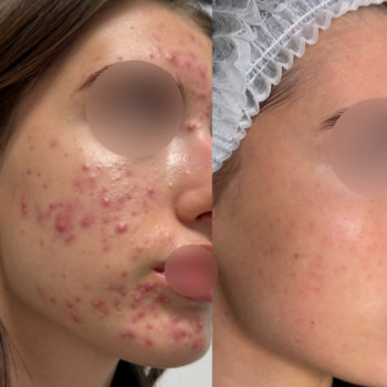 Єлізавета Антофійчук, Київ Фото - 1