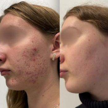 Єлізавета Антофійчук, Київ Фото - 4