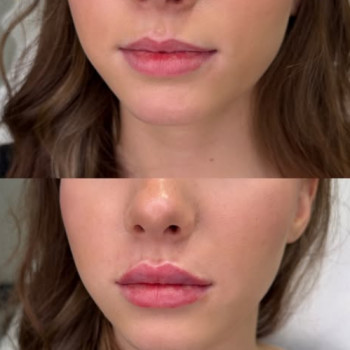 Єлізавета Антофійчук, Київ Фото - 5