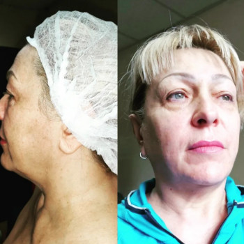 Яна Зуєва, Київ Фото - 2