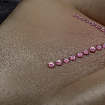 Корекція врослого волосся/ Інтимне відбілювання
                    Мастер депиляции  Тернополь