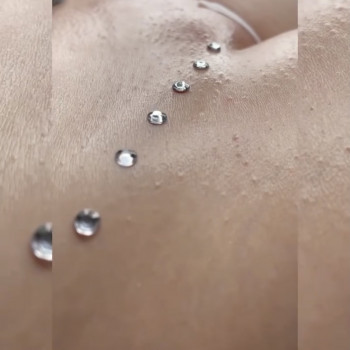 Корекція врослого волосся/ Інтимне відбілювання
                    Мастер депиляции  Тернополь