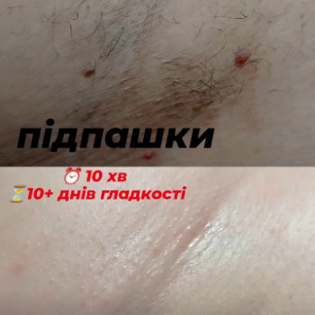 Зіна , Київ Фото - 4