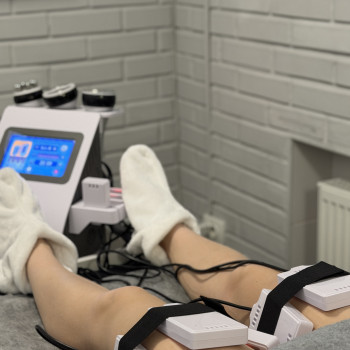 LazerPro100, Белая Церковь Фото - 1