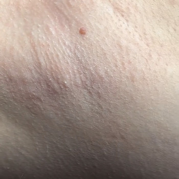 Електроепіляція
                    Викладач курсів краси Анна Дніпро