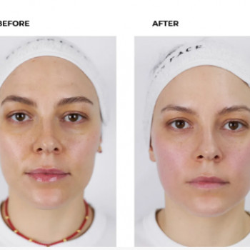 Fit for Face, Київ Фото - 1