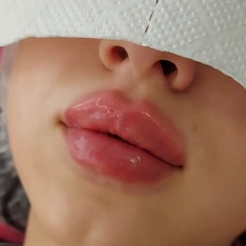 Фото из портфолио косметолога Ирина Василенко (Киев)