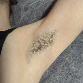 Воскова депіляція
                    Мастер депиляции  Киев