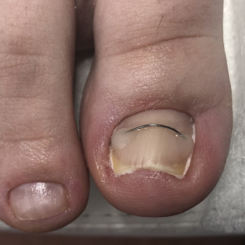 Ірина Абраменко, Кременчуг Фото - 5