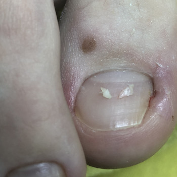 Ірина Абраменко, Кременчуг Фото - 8