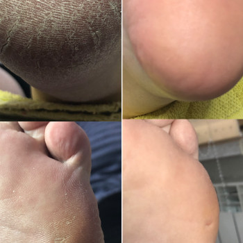 Ірина Абраменко, Кременчуг Фото - 4